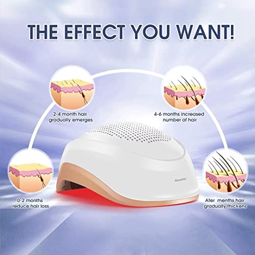 Laser Hair Growth Cap 180 Lasers, Hair Loss Treatments For Men and Women, Hair Regrowth Helmet For Thinning Hair, Low Level Laser Therapy Hair Growth Products