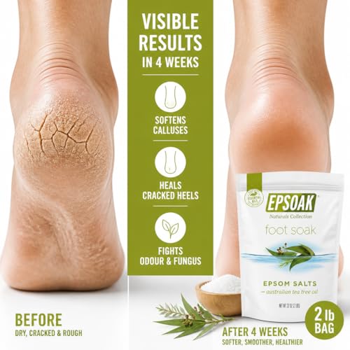 Epsoak 32oz Tea Tree Foot Soak with Epsom & Dead Sea Salts - USA Made