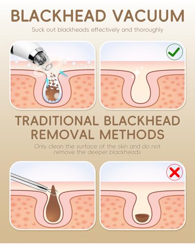 Blackhead Remover Pore Vacuum with 5 Probes & 3 Suction Levels