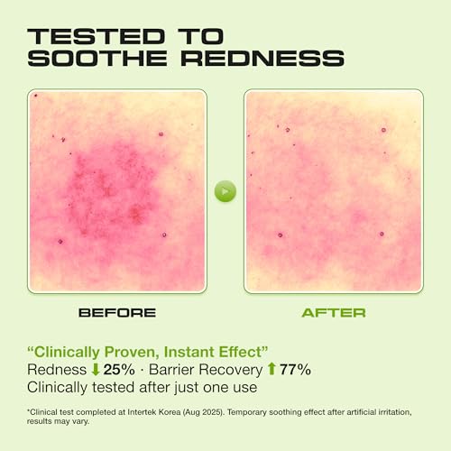 MIMI! CREAM SERIES ? Targeted Vegan Moisturizers for Acne-Prone, Sensitive & Dull Skin, Dermatologist-Tested, 0.67 fl oz (Madecassoside + Panthenol + Ectoin, 20ml / 0.67 fl oz)