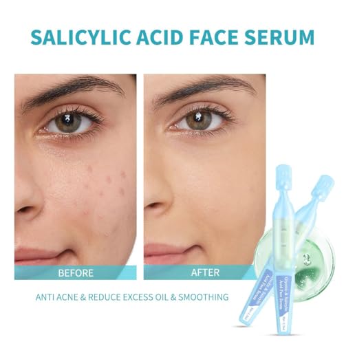 BACHERI Salicylic Acid Serum for Face with Glycolic Acid, Azelaic Acid, Redness Relief, Hydrating & Smoothing Serum, Anti Aging Facial Serum, 5 Ampoules