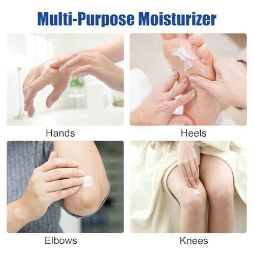Urea Cream 60% plus 2% Salicylic Acid for Feet Maximum Strength - Lotion For Dry Cracked Feet Elbows Knees Heels Hands, Hydrates Foot Care for Softening and Moisturizing, Callus Remover 10.1oz