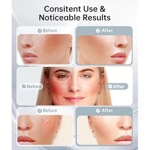 Red Light Therapy for Face and Neck, 7 Color Facial Massager with Adjustable Vibration and Thermals for Wrinkles, Double Chin, Portable Skin Care Tool with Base, White