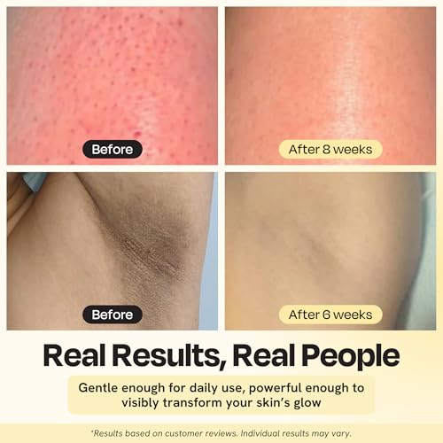 Gleamin Glow Body Bar - Turmeric and Kojic Acid Soap with Vitamin C for Visible Brightening & Smooth Texture - Helps Fade the Look of Dark Spots & Prevent Ingrowns - Vegan - 100g