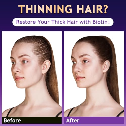 Biotin Hair Growth Shampoo for Thinning Hair, 10.1 Fl Oz