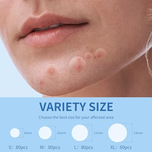 Daolyo Acne Patches 300 Count - Hydrocolloid Pimple Stickers