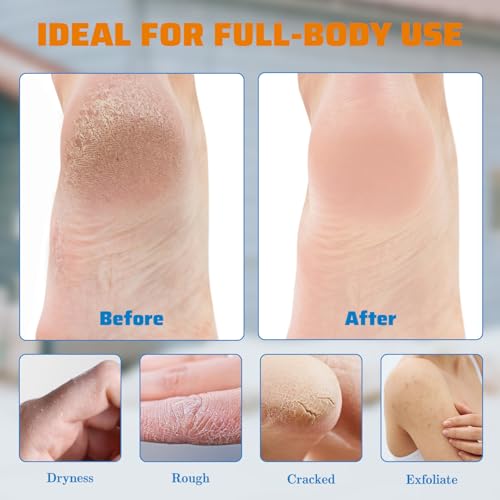 60% Urea Foot Cream with 2% Salicylic Acid - Deep Moisturizing for Dry Cracked Skin
