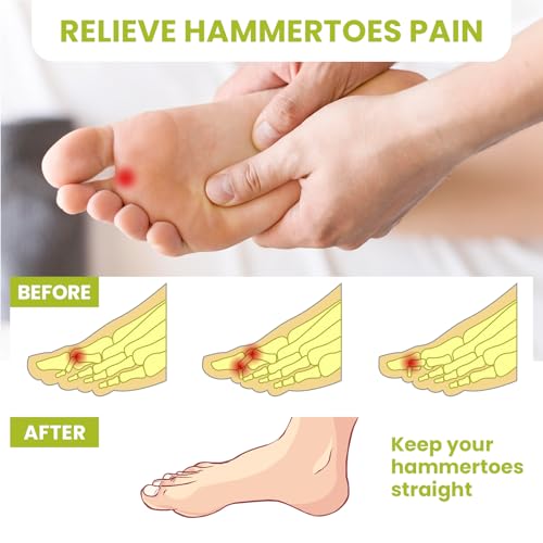 Hammertoe Corrector Gel Toe Straighteners - 12 Pcs Multi-Size