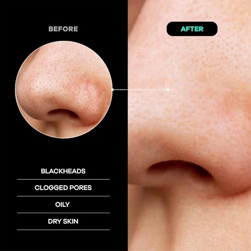 Dermasuri Deep Exfoliating Face Mitt – Dead Skin Remover