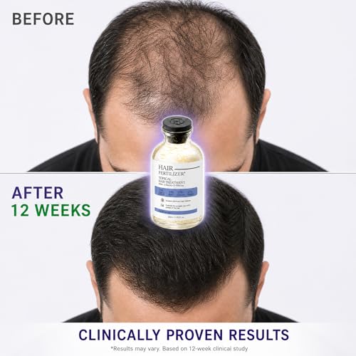 Hair Growth Serum with Redensyl & Biotin - DHT Block