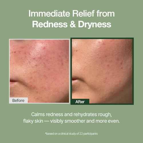 Green Caper Deep Hydration Cream (80ml / 2.70 Fl oz) Calming, Soothing, Panthenol, Hydrating for Sensitive and Dry Skin, Face Moisturizer, NDP