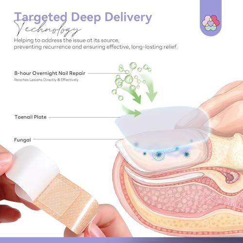 SAVILAND 1% Tolnaftate Fungal Nail Patches - Overnight Repair (32 Pcs)