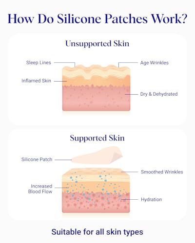 Wrinkles Schminkles Reusable Silicone Hand Wrinkle Patches - 2 Pack