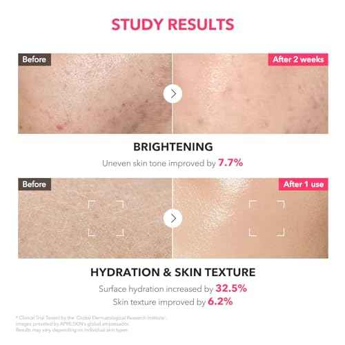 APRILSKIN TXA+Niacinamide 99 Pink Milky Toner | 99% High-Purity TXA 3%+ Niacinamide 5% for Brightening | Highly Concentrated Cream Toner | Deep Moisturizing Formula for Dull Skin | 5.07 fl.oz.
