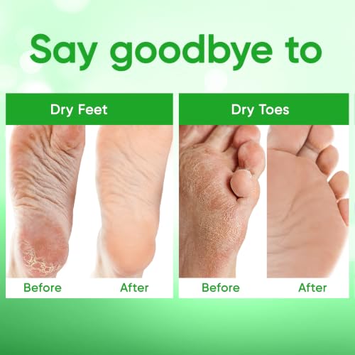 CÉLOR Foot Peel Mask for Dead Skin & Callus Removal - Aloe Vera & Nourishing Ingredients, 2 Pairs