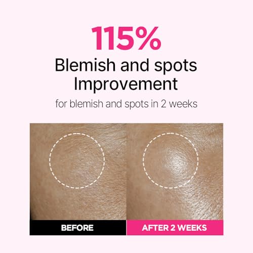 ISOI Blemish Care Up Facial Serum Triple Set, Korean Skin Care Set for Glass Skin Radiance, 2 Full Size & 1 Refill, Eye & Wrinkle Patch Tester, Daily Hydration Skincare Gift for Women (2.13 fl. oz)