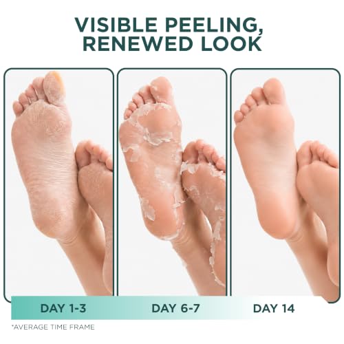 DERMORA Foot Peel Mask - 2 Pairs Exfoliating Booties for Dry Feet