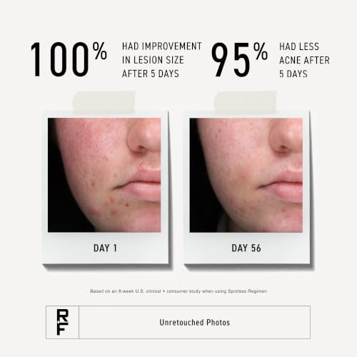 Rodan + Fields Spotless Daily Acne Wash 125mL - Face Cleanser for Breakouts & Oily Skin