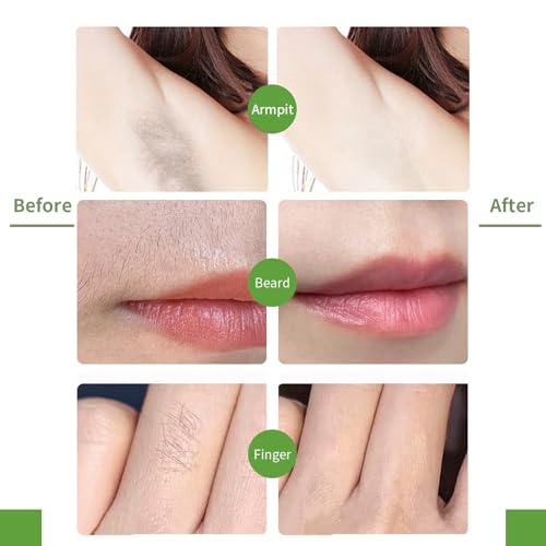 Facial Wax Strips for Women ? 98% Natural, Hypoallergenic Formula for Sensitive Skin ? Quick & Gentle Hair Removal for Upper Lip, Eyebrows, Chin, Bikini Line & Legs 40Pcs