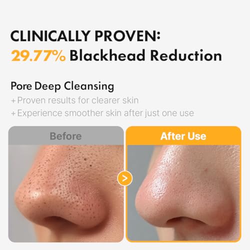 Hanskin Pore Care Duo ? PHA Cleansing Oil & Cleansing Foam | Blackhead Removal, Gentle Exfoliation & Pore Care for Oily, Acne-Prone & Combination Skin | Korean Skincare Set, K-Beauty