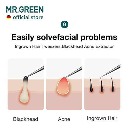 MR.GREEN Ingrown Hair Tweezers - Pointed Tips for Eyebrows & Blackheads