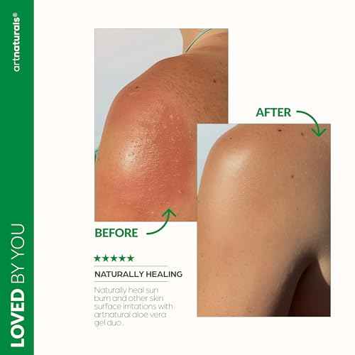 artnaturals Aloe Vera Gel Set - JUMBO 20oz - Sunburn Relief & Hydration for Face, Body, Scalp & Hair - Calming Moisturizer After Sun Exposure - Freshly Harvested within 12 Hours