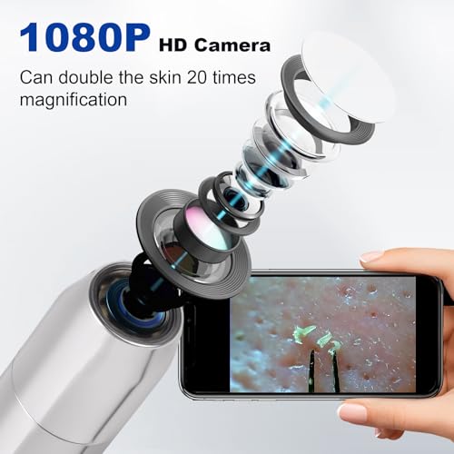 KOSIMAI Silver Blackhead Remover Tool with HD Camera & 30x Magnification
