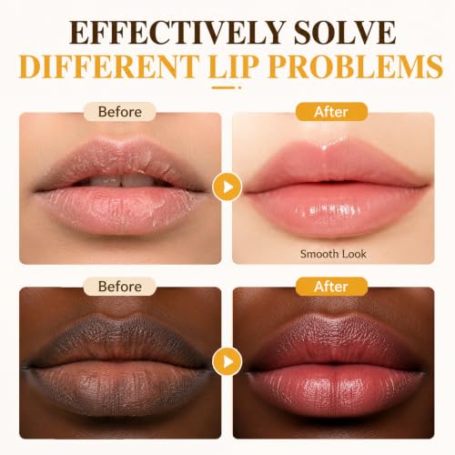 MUREND Turmeric Lip Balm - Dark Lip Treatment & Moisturizer (2PCS)