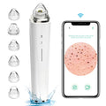 Blackhead Remover Pore Vacuum with 5MP Camera & 20X Magnification