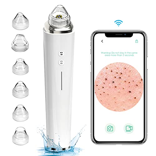 Blackhead Remover Pore Vacuum with 5MP Camera & 20X Magnification