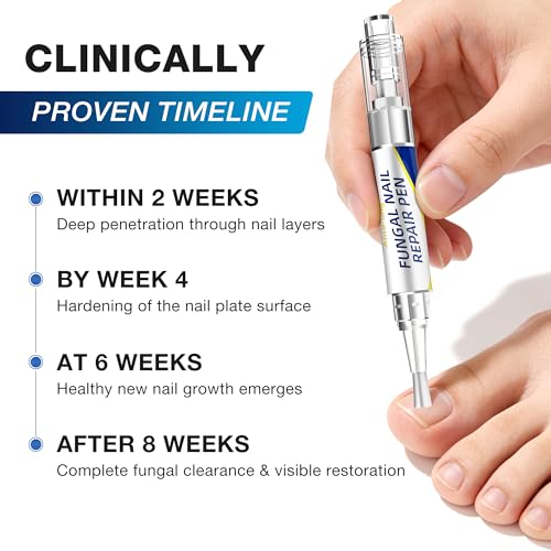 AntiFung Toenail Fungus Treatment Pen - 25% Undecylenic Acid