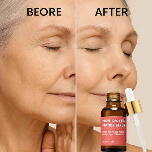 Salmon DNA PDRN 120,000 ppm EGF Peptide Microneedling Serum w/Volufiline, Phyto PDRN 12%, Growth Factor - Anti-Aging Face Serum with Niacinamide, Hyaluronic Acid 1 Fl Oz Korean Skincare