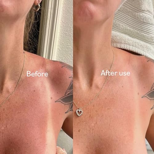 TERNS Mayday After-Sun Lotion - Sunburn & Redness Relief, 2 Oz