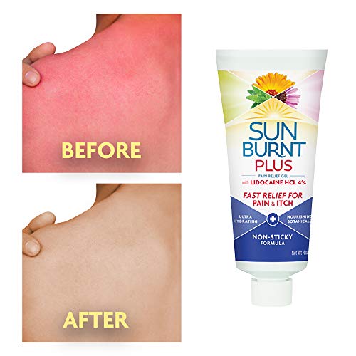 Sunburnt Plus After-Sun Gel with Lidocaine, 4 oz