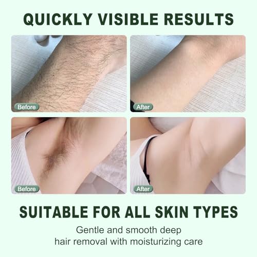 AgeVance Cyperus Rotundus Hair Removal Cream 3.52 Oz - Gentle Painless Women’s Skin Moisturizer & Hair Eliminator, Pack of 1
