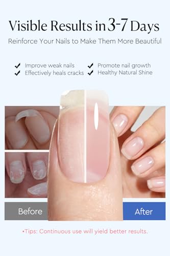 AzureBeauty Nail Strengthener 18ml for Weak & Damaged Nails