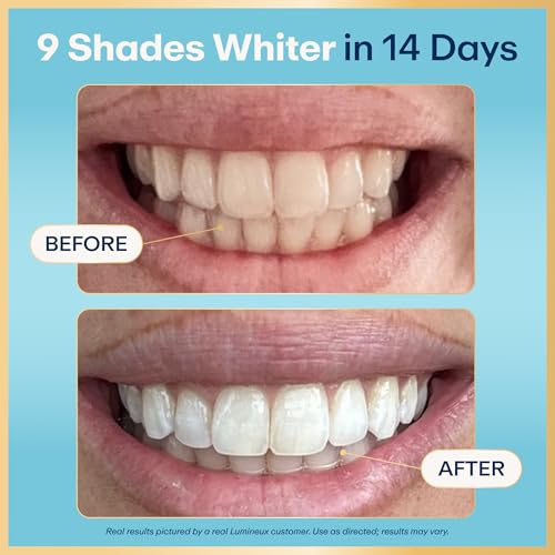 Lumineux Peroxide-Free Teeth Whitening Strips, 9 Treatments