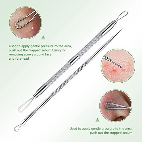 5-Piece Blackhead Remover Tool Kit - Pimple Popper Extractor Set