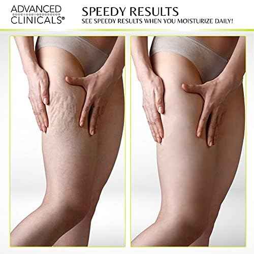 Advanced Clinicals Green Coffee Bean Oil Firming Cream + Vitamin C Body Oil Set