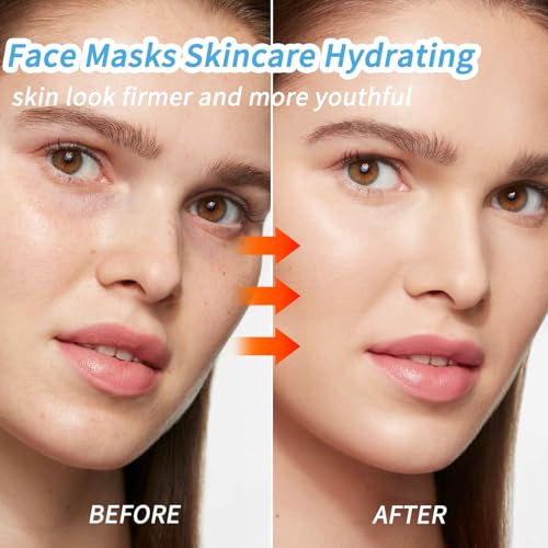 IREV Hyaluronic Acid Face Masks Skincare, Hydrating Facial Masks, Deep Moisturizing Face Mask for All Skin Types, Facial Sheet Mask for Women Skin Care, Smoothing Rejuvenating 10 Pack
