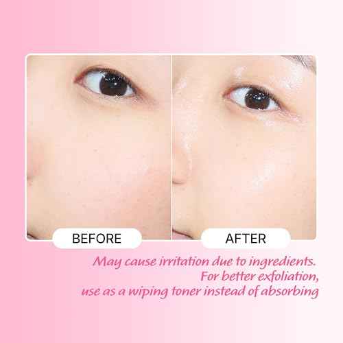 TOUCH IN SOL No Poreblem AHA BHA PHA Toner - Glycolic & Salicylic Acid Liquid Exfoliator - Makeup Prep & Pore Cleanser - Exfoliate, Soothe & Refresh Skin for Brighter Complexion