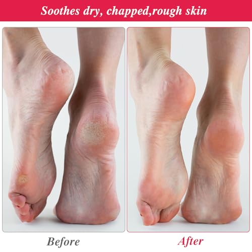 10-Pack Reusable Moisturizing Spa Cotton Socks for Dry Cracked Feet