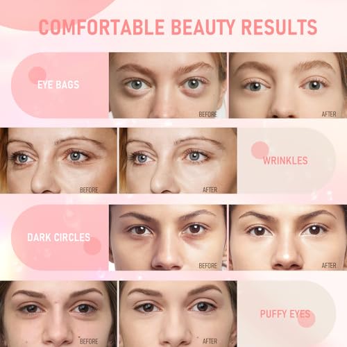 LAVONE Eye Mask - 30 Pairs Rose Under Eye Patches Skin Care Products,Eye Masks Skincare for Dark Circles and Puffiness, Reduce Wrinkles, Eye Bags and Fine Lines, for Women and Man