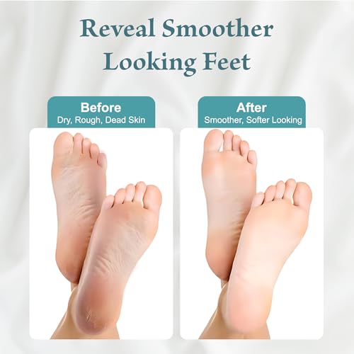 Exfoliating Foot Peel Mask 2-Pack for Dead Skin & Callus Removal