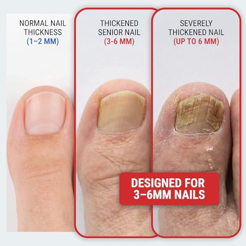 Heavy Duty Toenail Clippers for Thick Nails - Ergonomic Long Handle with Curved Blades