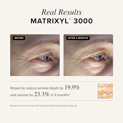 Asterwood Matrixyl 3000 + Argireline Serum with Hyaluronic Acid - Anti-Aging, Wrinkle Reducing, Collagen Boosting - Fragrance-Free - 4 Fl Oz