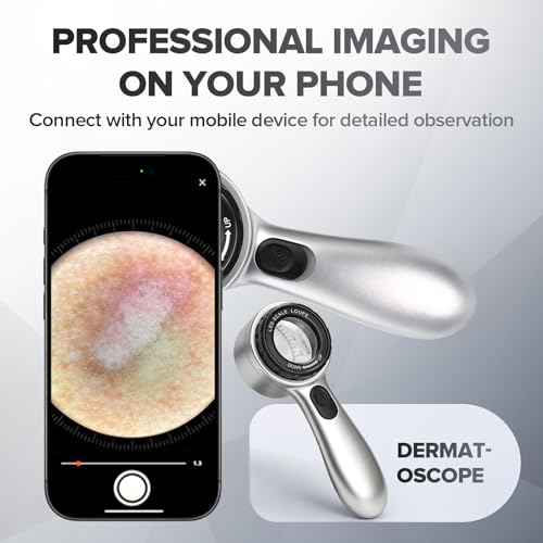 30x Magnifying Dermatoscope with LED - Rechargeable Skin Analyzer