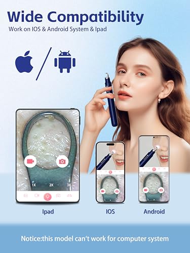 Visual Blackhead Remover with Camera 20X Extractor Kit for