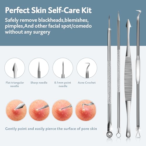 MENOLY 10-Piece Pimple Popper Tool Kit for Blackheads & Acne