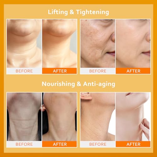 Instant Face Lift Cream with Collagen & Retinol, 1.7 Fl Oz